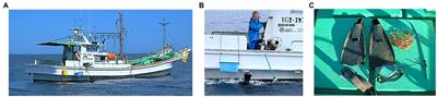 Decompression Illness in Repetitive Breath-Hold Diving: Why Ischemic Lesions Involve the Brain?